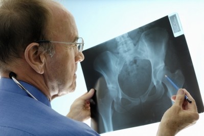 A recent study concluded that vitamin D played no role in reducing fracture risk in older adults. ©Getty Images - Fertnig