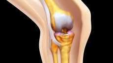 Easy Climb™ Helps Improve Joint Health in 30 Days